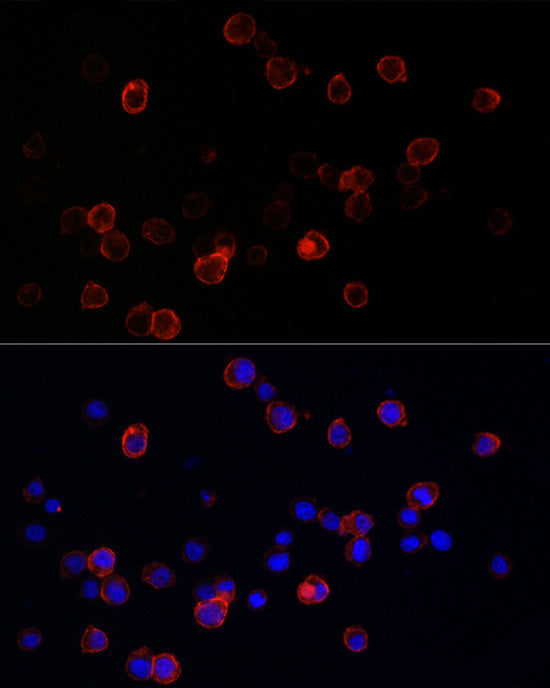 CD141/Thrombomodulin Rabbit mAb