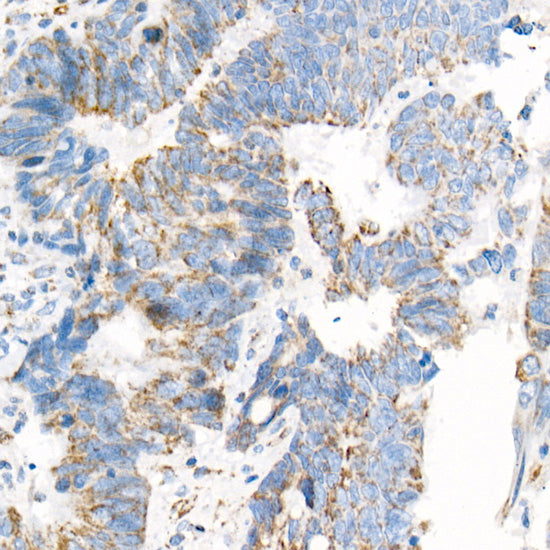 COX7A1 Rabbit mAb