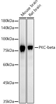 PKC-beta Rabbit mAb