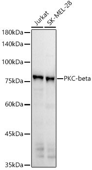 PKC-beta Rabbit mAb