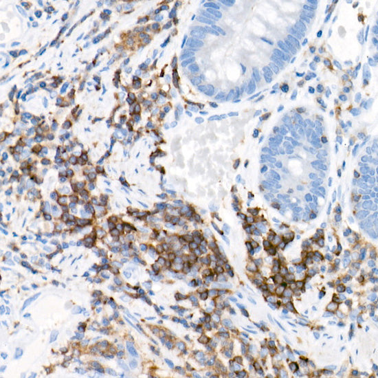 PKC-beta Rabbit mAb