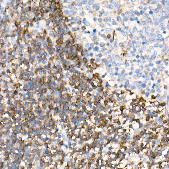 PKC-beta Rabbit mAb