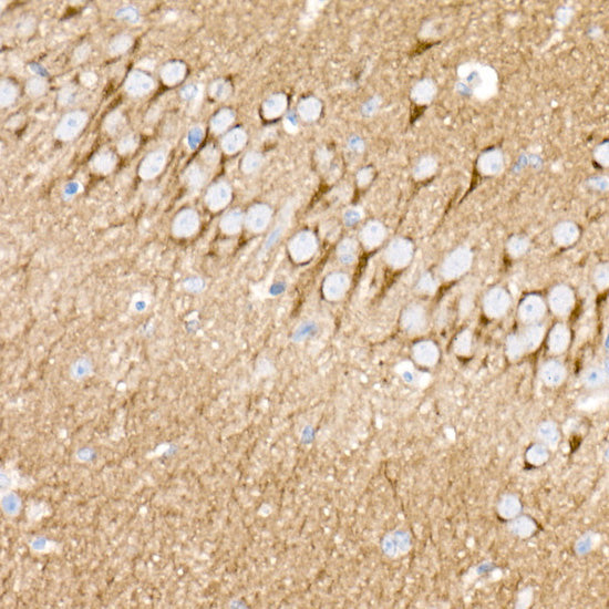 PKC-beta Rabbit mAb
