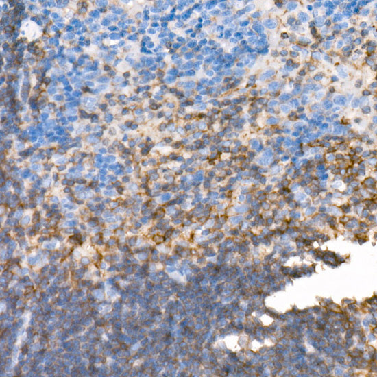 PKC-beta Rabbit mAb
