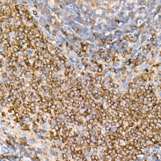 PKC-beta Rabbit mAb