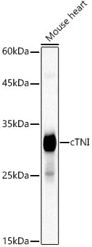 Cardiac Troponin I (TNNI3) Rabbit mAb