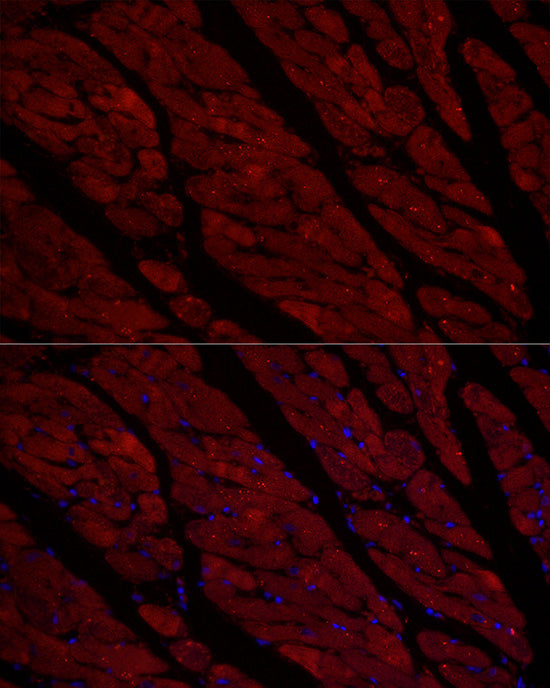 Cardiac Troponin I (TNNI3) Rabbit mAb