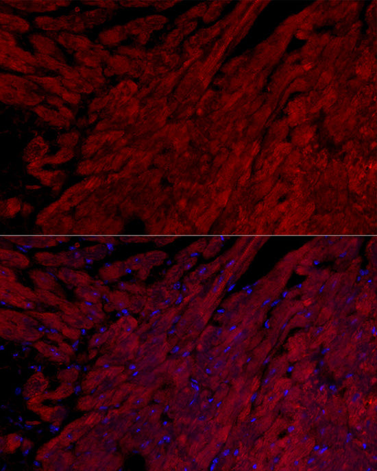 Cardiac Troponin I (TNNI3) Rabbit mAb