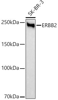 HER2/ErbB2 Rabbit mAb