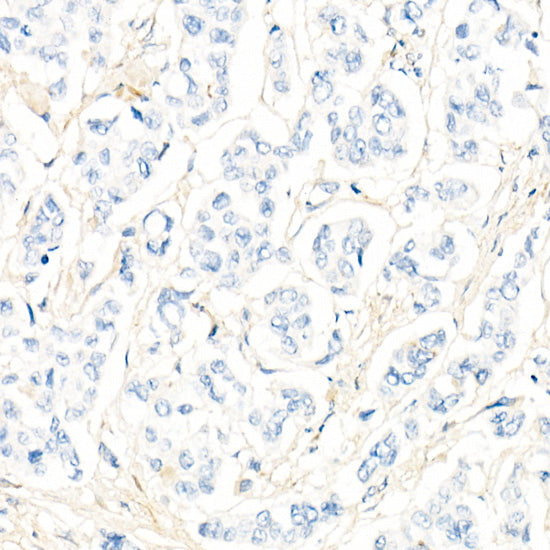 HER2/ErbB2 Rabbit mAb