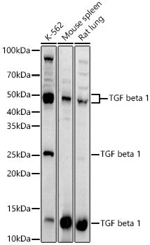 TGF beta 1 Rabbit pAb