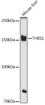 THBS1 Rabbit pAb