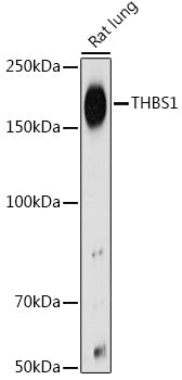 THBS1 Rabbit pAb