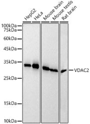 VDAC2 Rabbit mAb