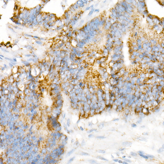 VDAC2 Rabbit mAb