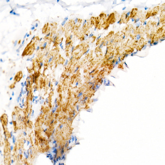 VDAC2 Rabbit mAb