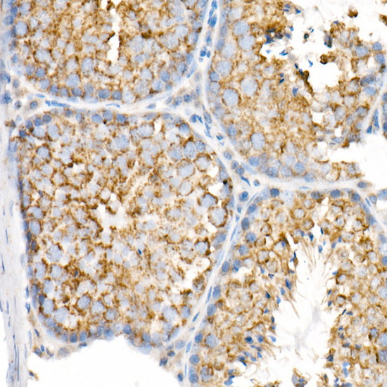 VDAC2 Rabbit mAb