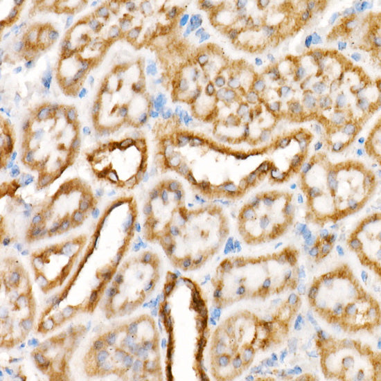 VDAC2 Rabbit mAb