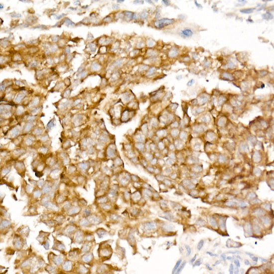 LIN28A Rabbit mAb