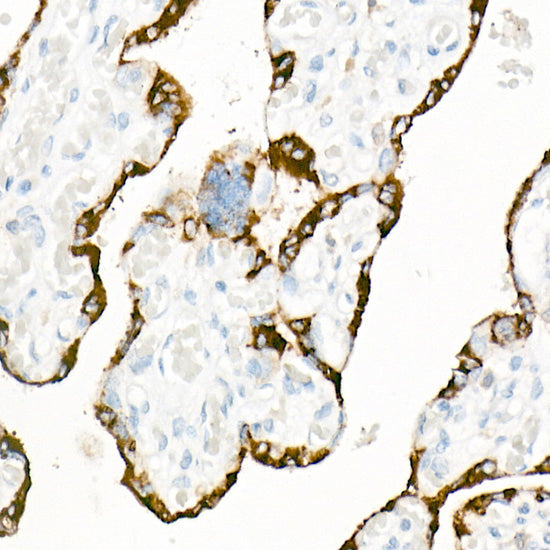 LIN28A Rabbit mAb