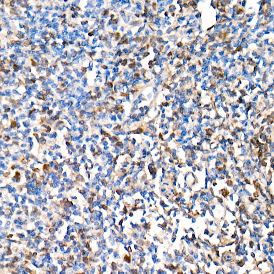 Interferon alpha 2 (IFN-α2） Rabbit mAb