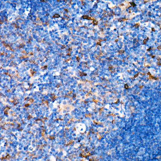Interferon alpha 2 (IFN-α2） Rabbit mAb