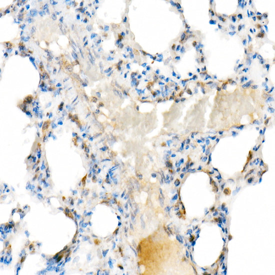 Interferon alpha 2 (IFN-α2） Rabbit mAb