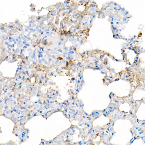 IL-6 Rabbit mAb