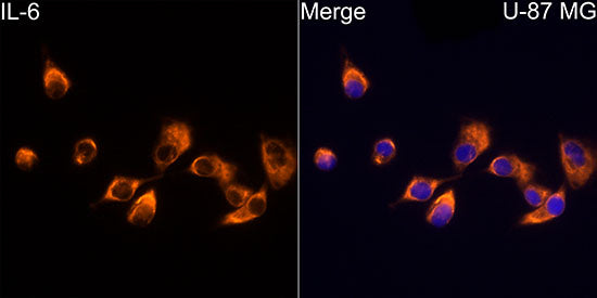 IL-6 Rabbit mAb