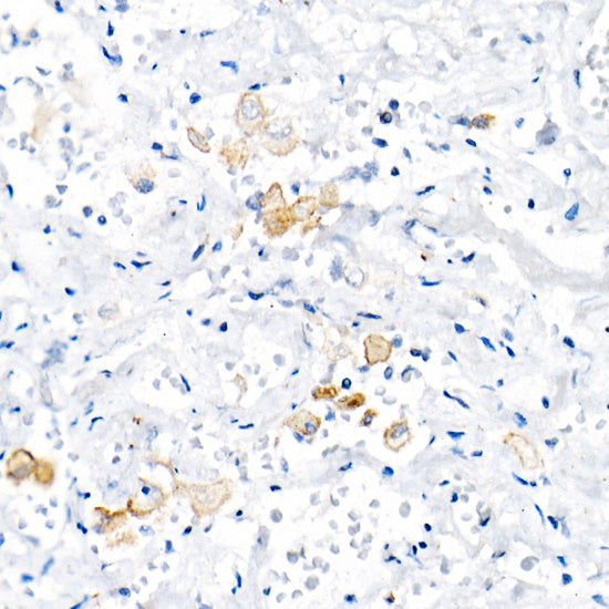 TNF-α Rabbit mAb