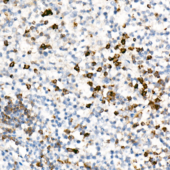 IL17A Rabbit mAb