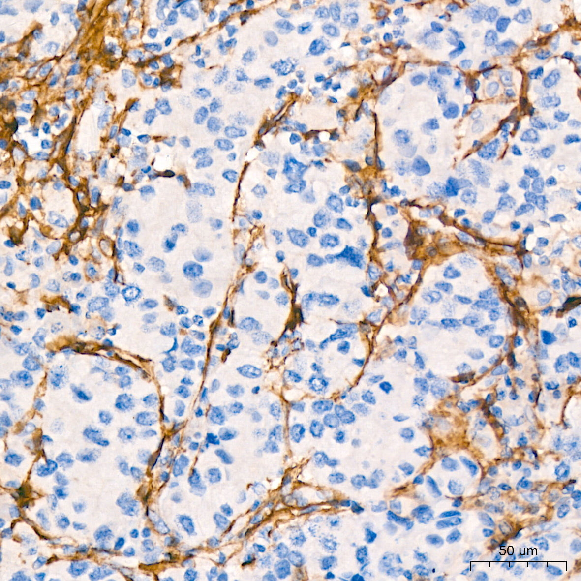 CD13/ANPEP Rabbit mAb