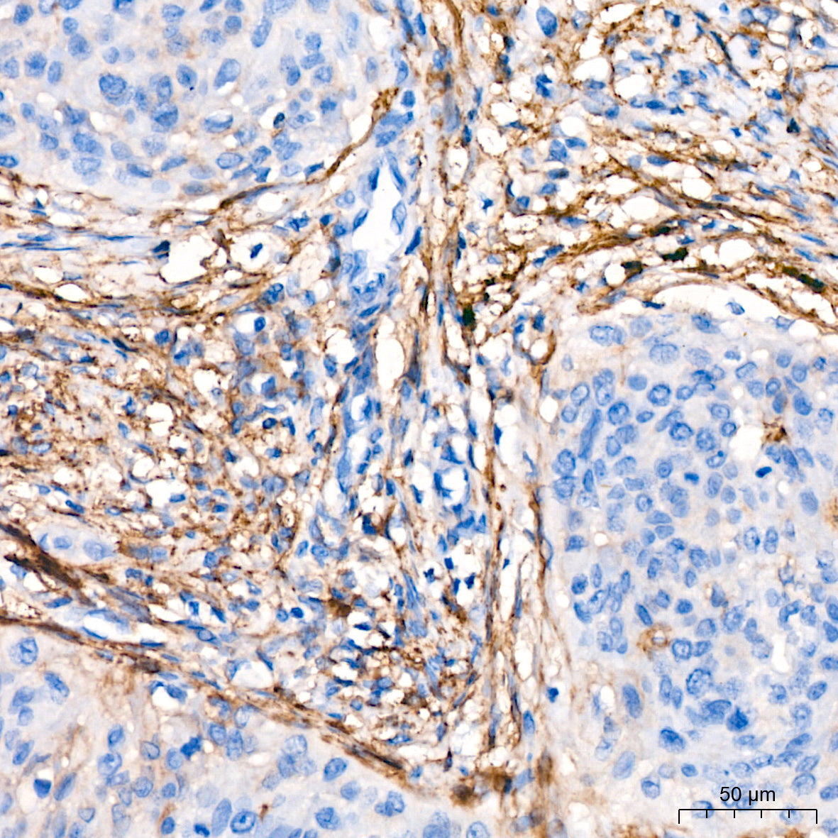 CD13/ANPEP Rabbit mAb