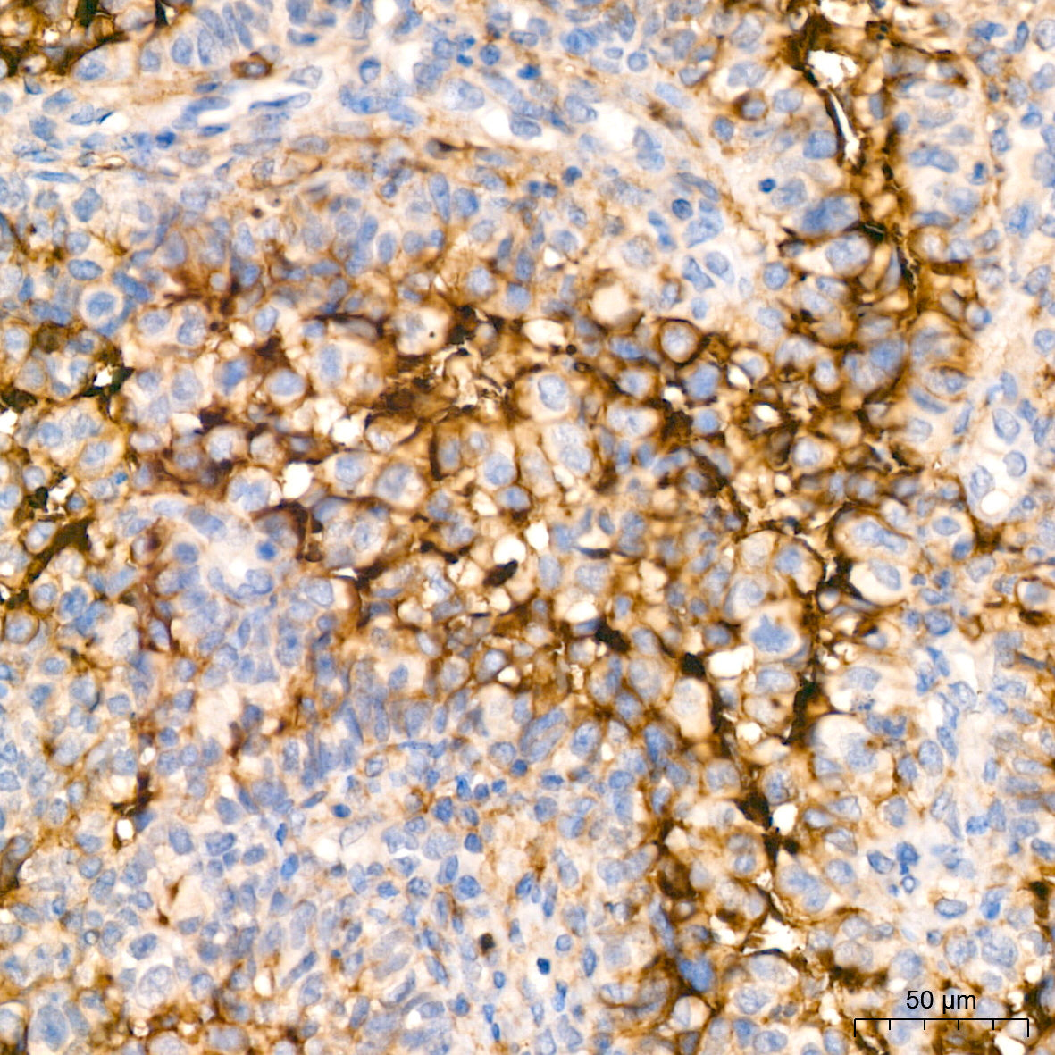 CD13/ANPEP Rabbit mAb