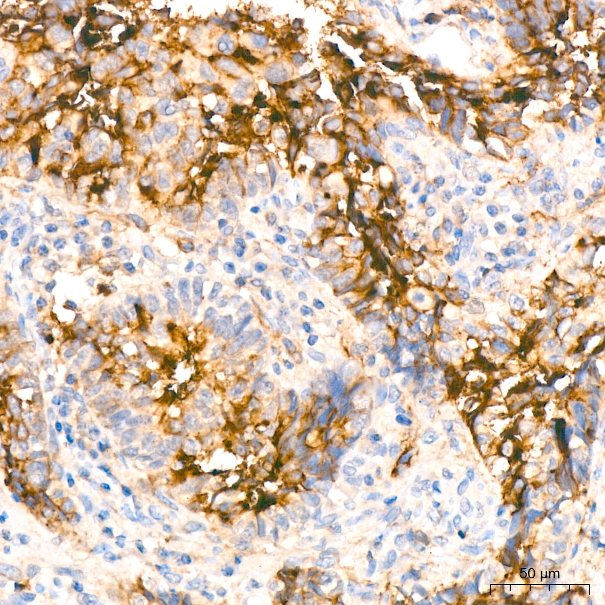 CD13/ANPEP Rabbit mAb