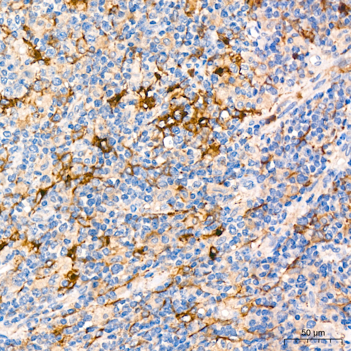CD13/ANPEP Rabbit mAb
