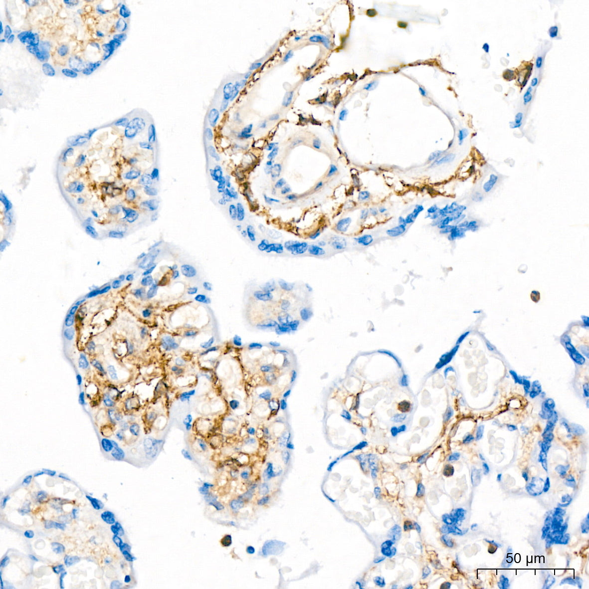 CD13/ANPEP Rabbit mAb