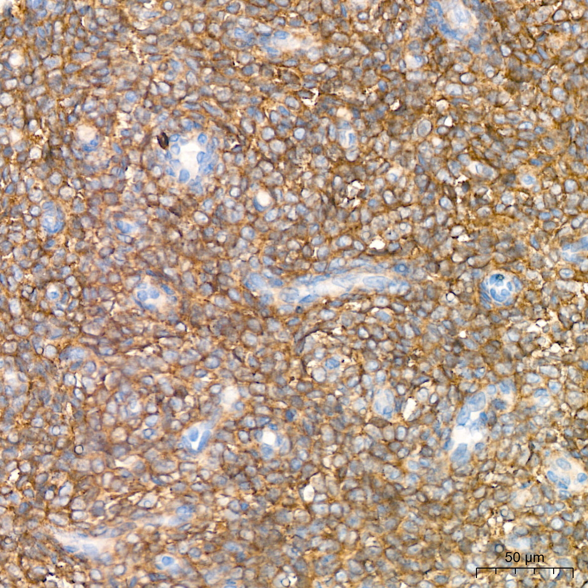 CD13/ANPEP Rabbit mAb