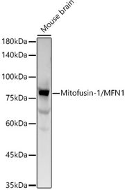 Mitofusin-1/MFN1 Rabbit mAb
