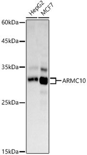 ARMC10 Rabbit pAb