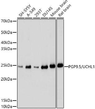 PGP9.5/UCHL1 Rabbit pAb