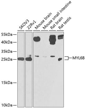 MYL6B Rabbit pAb