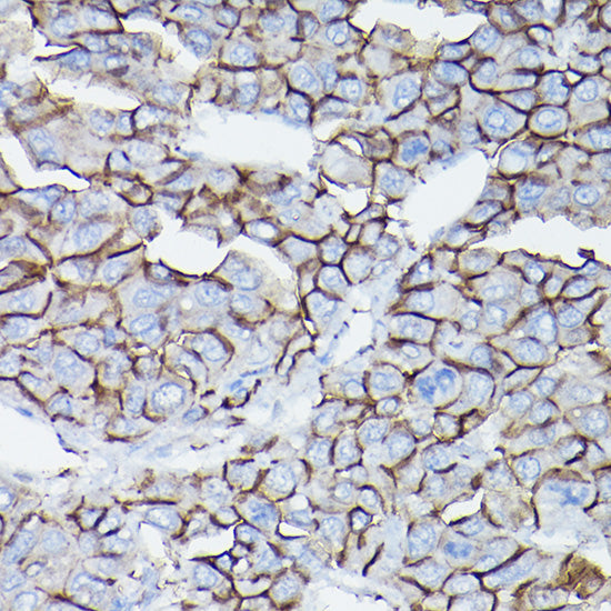 δ-Catenin/p120 Catenin Rabbit pAb