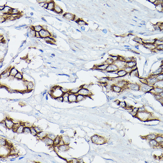 δ-Catenin/p120 Catenin Rabbit pAb