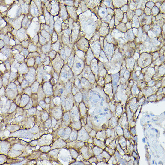 δ-Catenin/p120 Catenin Rabbit pAb