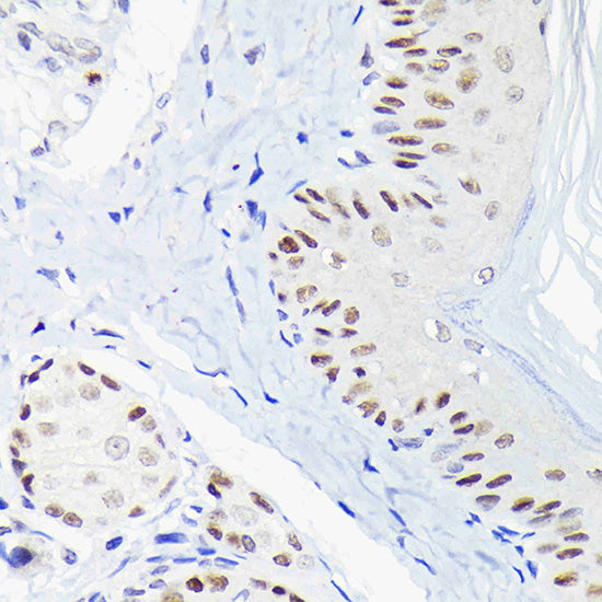 p63 Rabbit pAb