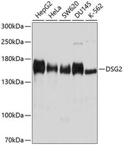 DSG2 Rabbit pAb