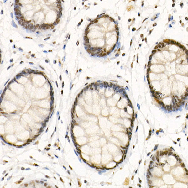 HDAC3 Rabbit pAb