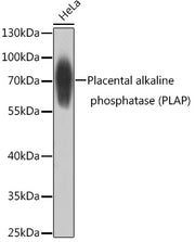 Placental alkaline phosphatase (PLAP) Rabbit pAb