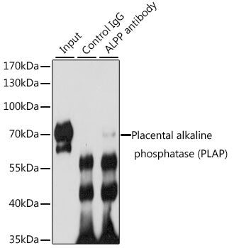 Placental alkaline phosphatase (PLAP) Rabbit pAb